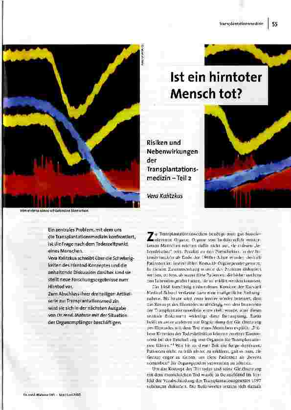 [doc_117460] Ist ein hirntoter Mensch tot?